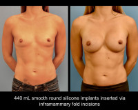 AG16