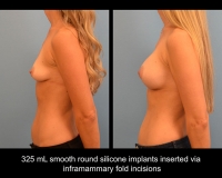 AugFeb3